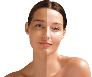 Pomaže ujednačiti ten i posvjetliti kožu